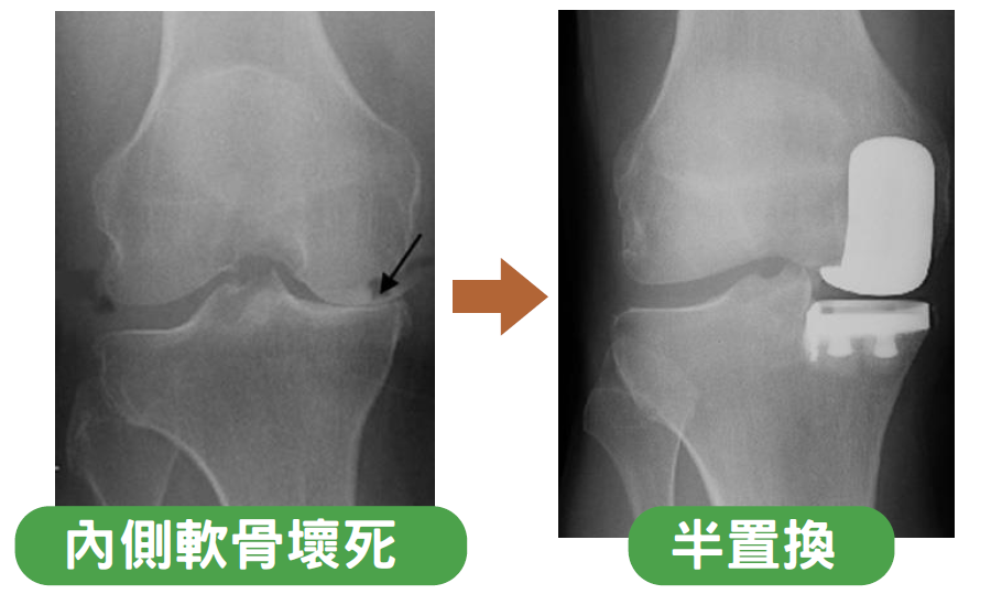 UKR X-ray